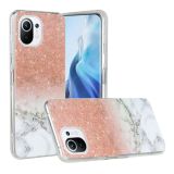 For Xiaomi Mi 11 Lite Marble Pattern Soft TPU Protective Case(White Gold)